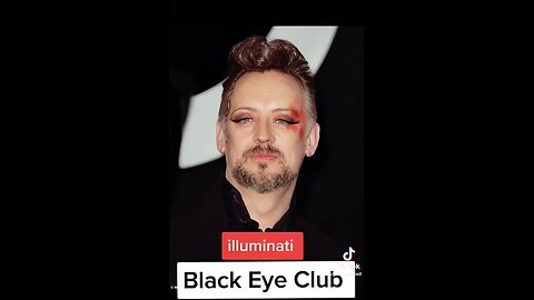 Black Eye Club?