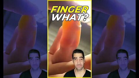 What do you think this is? #Finger