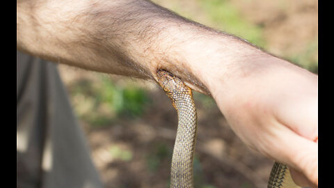 OMG the real snake bite on hand the man is crying 🥲