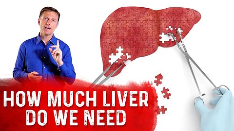 Can We Live Without a Liver?