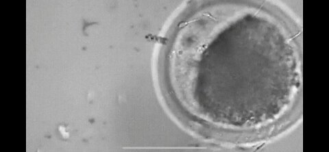 NANOBOT GRABS SPERM : INSEMINATES EGG AND SMOKES A CIGARETTE