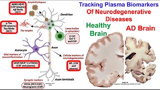 Kynurenine/Tryptophan Is Associated With Biomarkers Of Neurodegenerative Disease