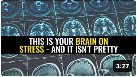 This is your brain on stress - and it isn't pretty