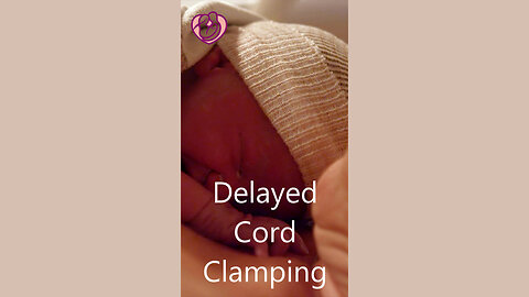 Delayed Umbilical Cord Clamping: 7 Benefits