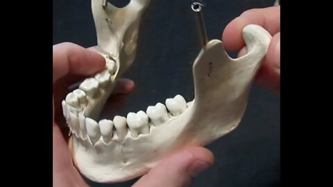 Identification of Bony Landmarks - Mandible (Skull)