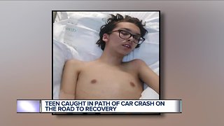 Port Huron teen recovering in Children's Hospital after near death hit-and-run