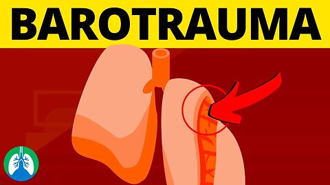 Pulmonary Barotrauma (Medical Definition) | Quick Explainer Video