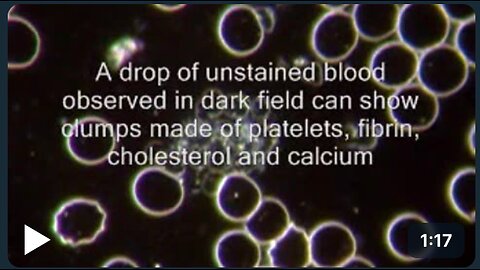 Thrombosis and cardio-vascular diseases