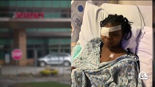 7-year-old in Garfield Heights hit in face by stray bullet urges shooter to turn themself in