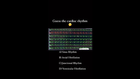 Guess the cardiac rhythm. 🤔