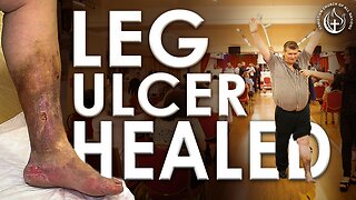 LEG ULCER HEALED IN JESUS' NAME!!!