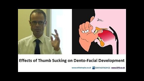 Effects of Thumb Sucking on Dento-Facial Development by Dr Mike Mew