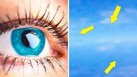 If You’re Seeing Eye Floaters, Here’s What to Do About Them