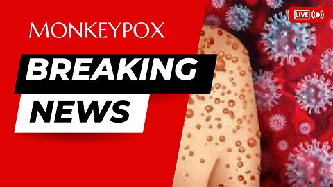 #Monkeypox Alert, #Understanding Monkeypox, #The Truth About Monkeypox