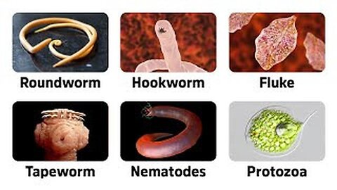 9 Warning Signs of Parasites - Dr. Eric Berg