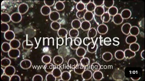 White Blood Cells Live Blood Analysis