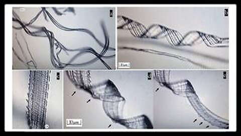 Recent Study Shows Self-Assembly Nanobots In The COVID-19 Injectables