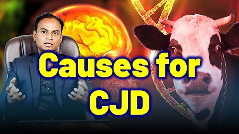 Causes for CJD, Creutzfeldt Jakob Disease, Prion Disease, Mad Cow, CWD. | Treatment Cure Relief