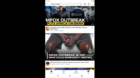 MPOX VIRUS EMERGENCY!!!! lock downs coming. KILLING THE YOUNG BABIES IN AFRICA ON ITS WAY HERE