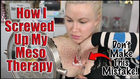 How I Screwed Up my Meso Therapy, Don't Make THIS Mistake | Code Jessica10 saves you Money