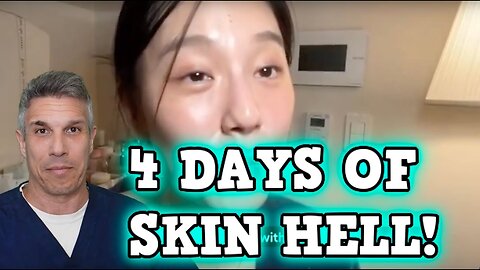 Derm reacts How I repair my skin barrier in 4 days at home, with affordable skincare routine