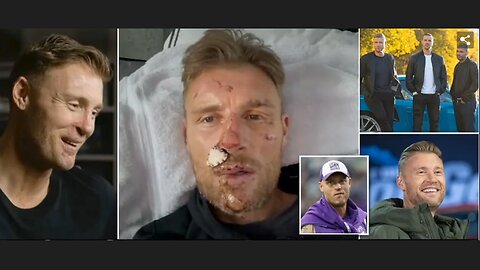 Freddie Flintoff's horrific injuries after Top Gear crash revealed