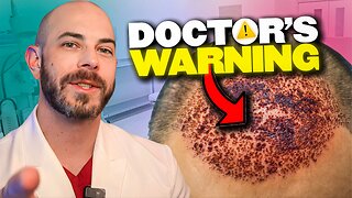 Hair Transplant Warnings - Doctor Explains