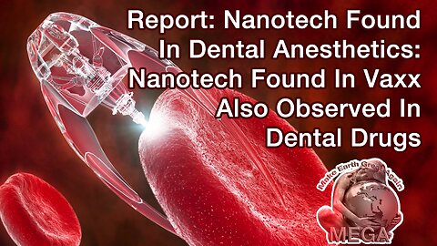 Report: Nanotech Found In Dental Anesthetics: Nanotech Found In Vaxx Also Observed In Dental Drugs