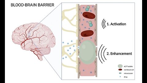 Wi-Fi and electromagnetic fields can open the blood-brain barrier