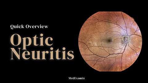 Optic Neuritis - Quick Overview for Exams in less than 2 minutes