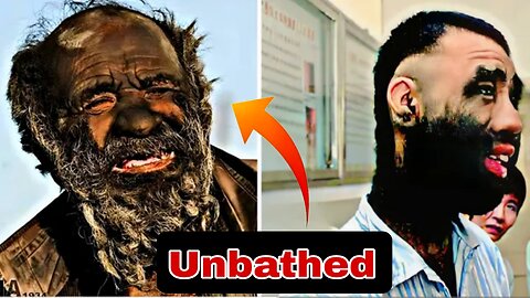 67 Years Unbathed - Embaracing Extra Hair On The Body | A Unique Journey