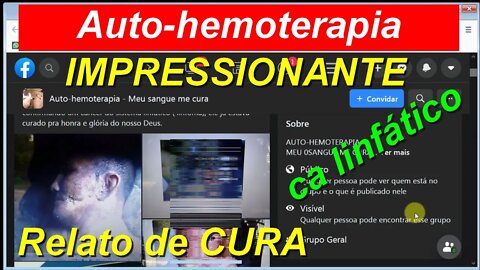 REGISTRO FOTOGRÁFICO COMPROVANDO A EFICÁCIA DA AUTO-HEMOTERAPIA EM CURA DE CÂNCER