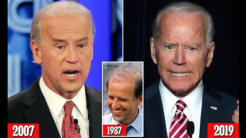 dementia Joe brandon Biden’s Forehead Looks SUSPICIOUS! - body double 6-4-23 Conservative Twins