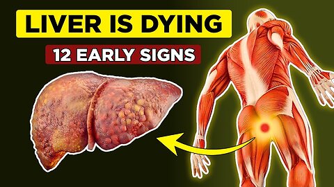 LIVER is DYING! 12 Weird Signs of Liver Damage