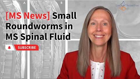 [MS News] Small Roundworms in MS Spinal Fluid