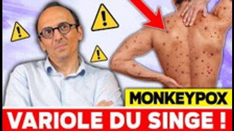 Monkeypox, Variole du Singe Le mensonge continue ! (Transmission, vaccination...)