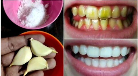 whiten your teeth at home !!