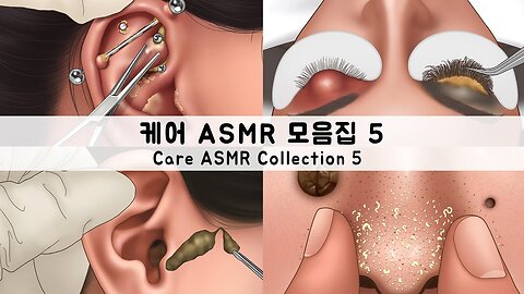 ASMR 케어 애니메이션 모음집5 | 귀지, 피어싱, 코피지, 다래끼 | CARE ANIMATION COLLECTION5 | Earwax, Piercing, sebum, stye