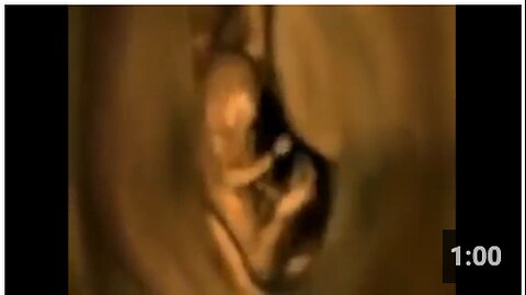 Scan captured footage of what unborn babies do in the womb