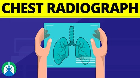 Chest Radiograph (Medical Definition) | Quick Explainer Video