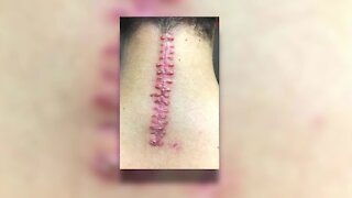 Family files lawsuit after student is hurt at SWFL Christian Academy