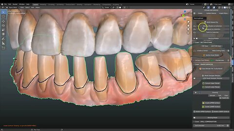 Using Medit margins for the B4D Crown Module