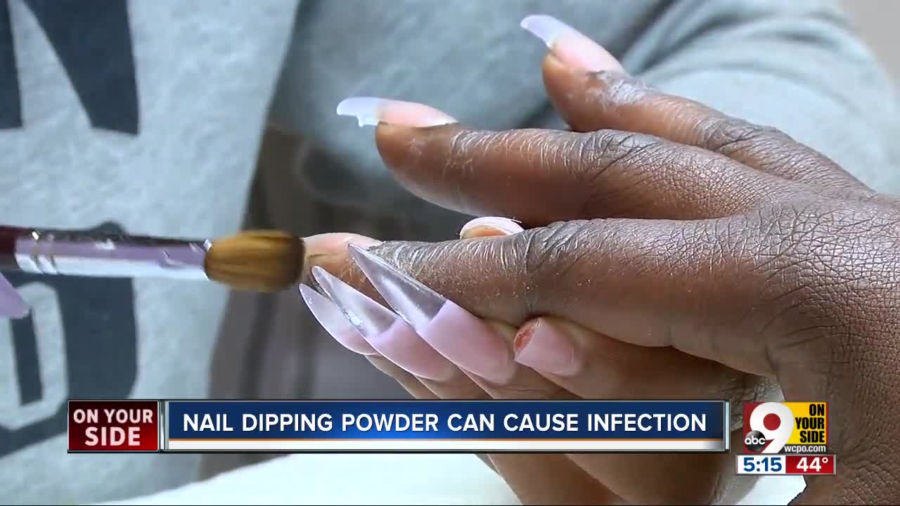 Nail-dipping powder can pose risk of infection