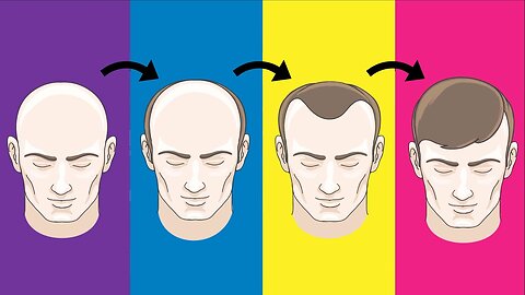 Top 5 Hair Loss Solutions That Actually Work