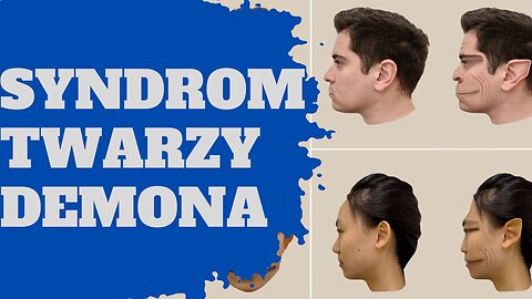 Syndrom twarzy demona - o co chodzi? Prozopometamorfopsja