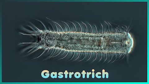 This is a gastrotrich cell.