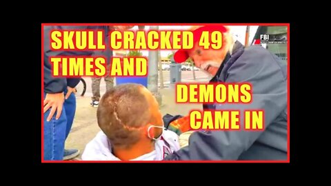 🔥 SKULL DEMONS OF TORMENT CAST OUT OF HIS SKULL CRACKED 49 TIMES