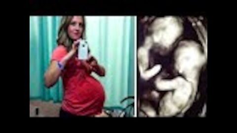 Unsuspecting Mom-To-Be Shocked After Ultrasound