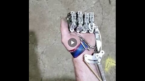 Engineer Ian Davis designed a mechanical prosthesis that operates without batteries or electricity.