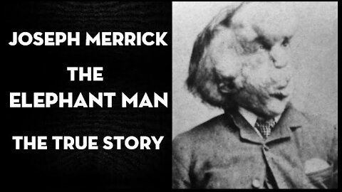 Joseph Merrick (The Elephant Man) The true story